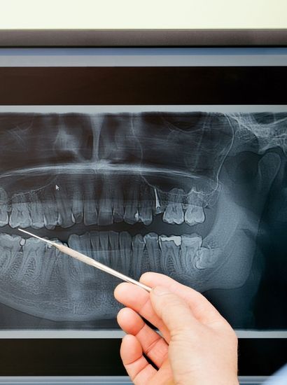 Dental x-rays and CT scans help us provide general dentistry services.