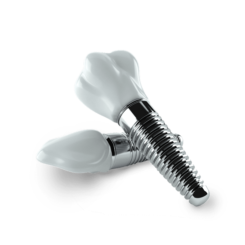 A screw retained implant crown is an extremely realistic tooth replacement option.