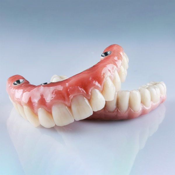 Close up photo of implant supported dentures.