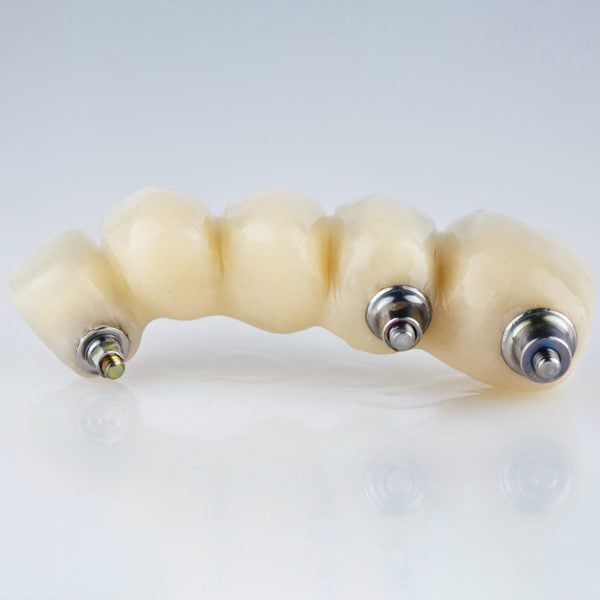 Implant supported dental bridges are available in Staunton and Bridgewater.