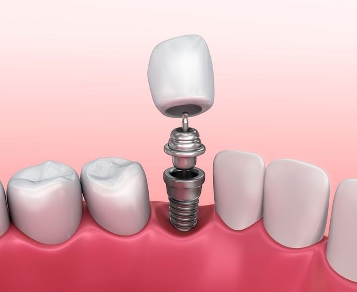 Restorative dentistry focuses on teeth repair and teeth restoration.