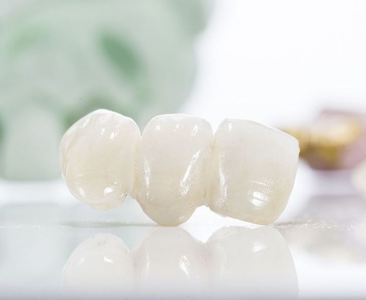 Dental bridges help fill the gap in your smile.