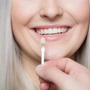 Porcelain dental veneer