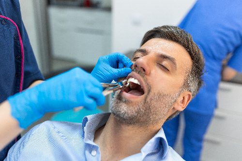 man having his tooth pulled