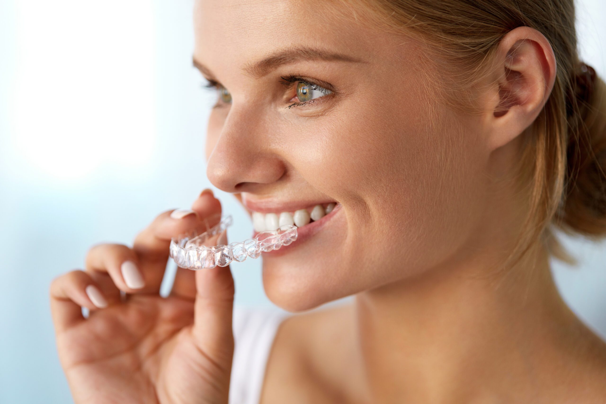 Closeup Of Beautiful Happy Smiling Woman With White Smile, Straight Teeth, Invisible Braces