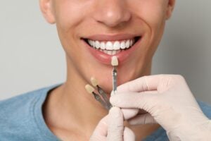 dentist in gloves checking a male patients tooth color against veneers